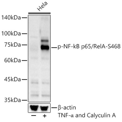 Phospho-NF-kB p65/RelA-S468 Rabbit pAb