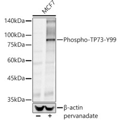 Phospho-TP73-Y99 Rabbit pAb