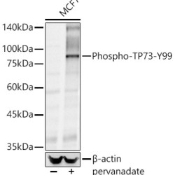 Phospho-TP73-Y99 Rabbit pAb