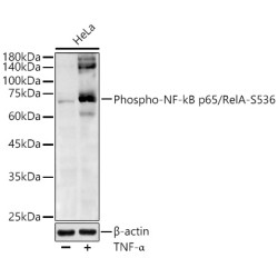 Phospho-NF-kB p65/RelA-S536 Rabbit pAb