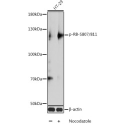Phospho-RB-S807/811 Rabbit pAb