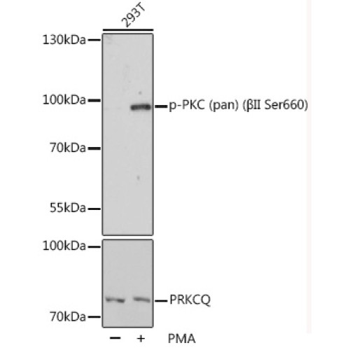 Phospho-PKC (pan) (βII Ser660) Rabbit pAb