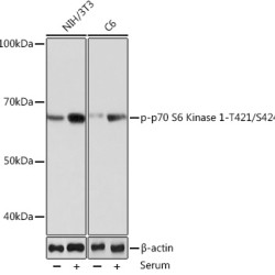 Phospho-p70 S6 Kinase 1-T421/S424 Rabbit mAb