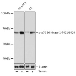 Phospho-p70 S6 Kinase 1-T421/S424 Rabbit mAb