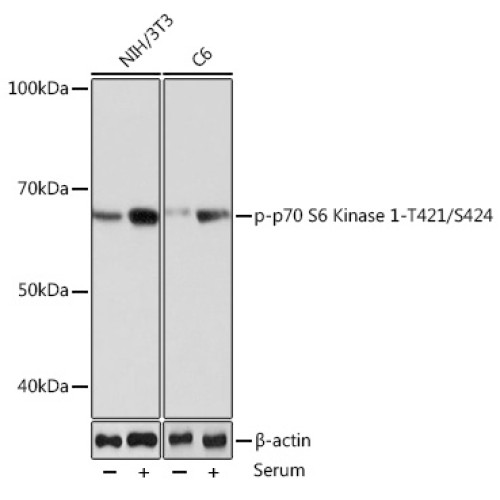Phospho-p70 S6 Kinase 1-T421/S424 Rabbit mAb