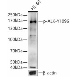 Phospho-ALK-Y1096 Rabbit pAb