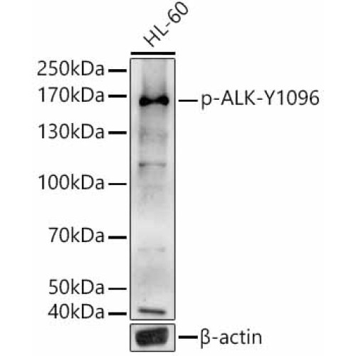 Phospho-ALK-Y1096 Rabbit pAb