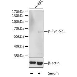 Phospho-Fyn-S21 Rabbit pAb