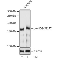 Phospho-eNOS-S1177 Rabbit pAb