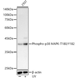 Phospho-p38 MAPK-T180/Y182 Rabbit pAb