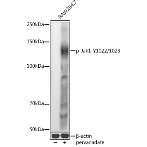 Phospho-Jak1-Y1034/Y1035 Rabbit pAb