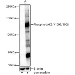 Phospho-JAK2-Y1007/1008 Rabbit pAb