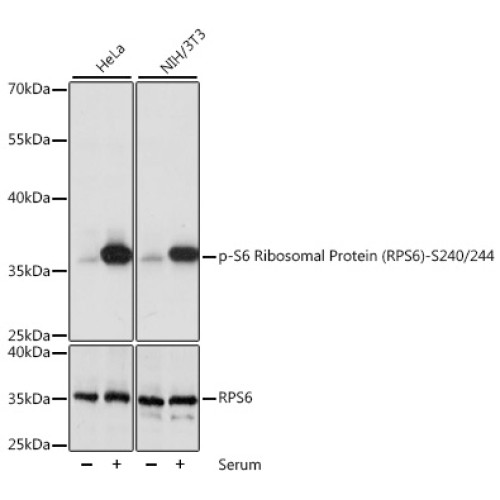 Phospho-S6 Ribosomal Protein (RPS6)-S240/244 Rabbit pAb