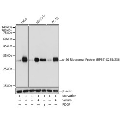 Phospho-S6 Ribosomal Protein (RPS6)-S235/236 Rabbit pAb
