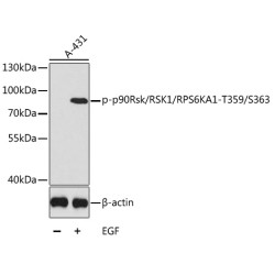 Phospho-p90Rsk/RSK1/RPS6KA1-T359/S363 Rabbit pAb