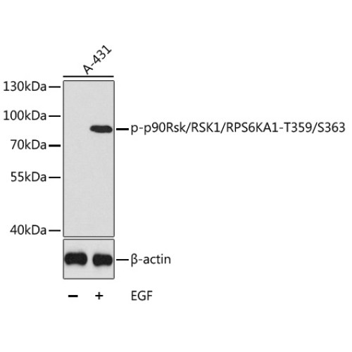 Phospho-p90Rsk/RSK1/RPS6KA1-T359/S363 Rabbit pAb
