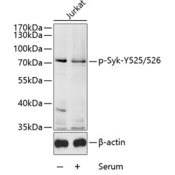 Phospho-Syk-Y525/526 Rabbit pAb