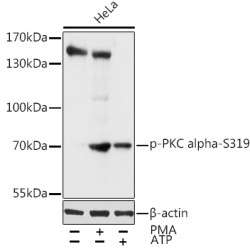 Phospho-PKC alpha-S319 Rabbit pAb