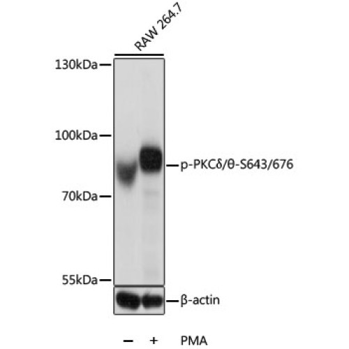 Phospho-PKCδ/θ-S643/676 Rabbit pAb