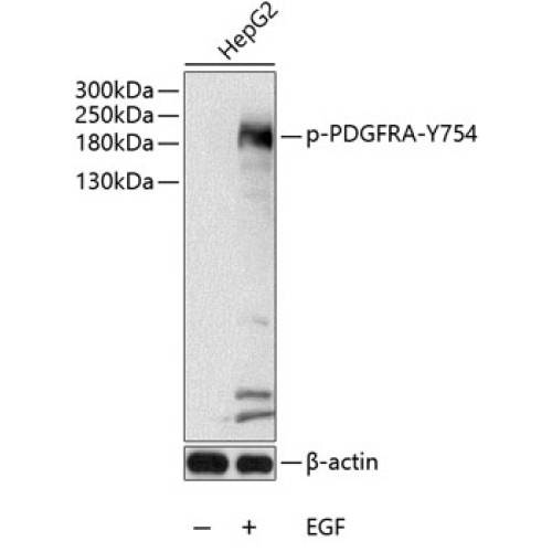 Phospho-PDGFR alpha-Y754 Rabbit pAb
