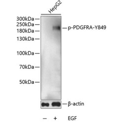 Phospho-PDGFR alpha-Y849 Rabbit pAb