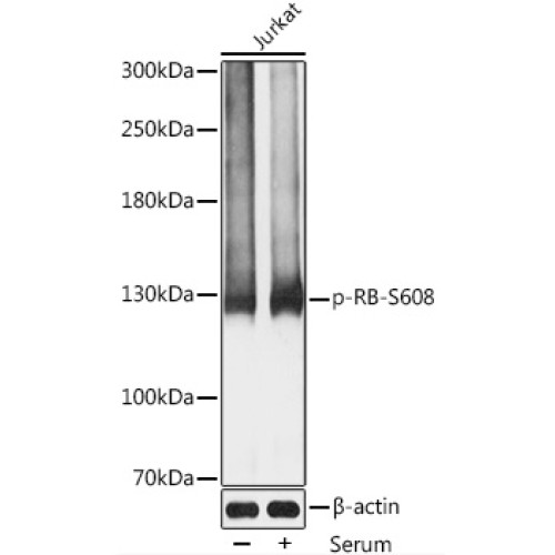 Phospho-RB-S608 Rabbit pAb