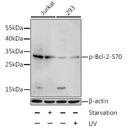 Phospho-Bcl-2-S70 Rabbit pAb