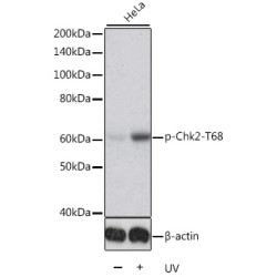 Phospho-Chk2-T68 Rabbit pAb