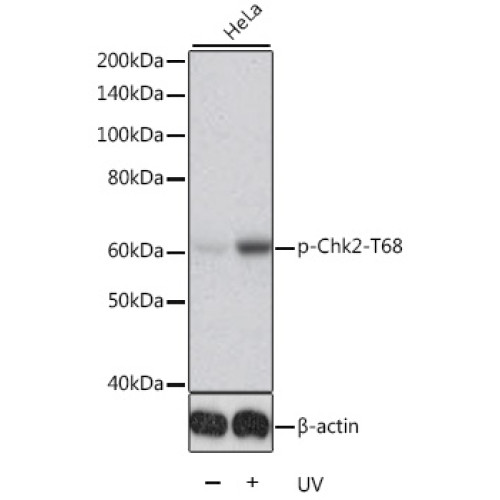 Phospho-Chk2-T68 Rabbit pAb