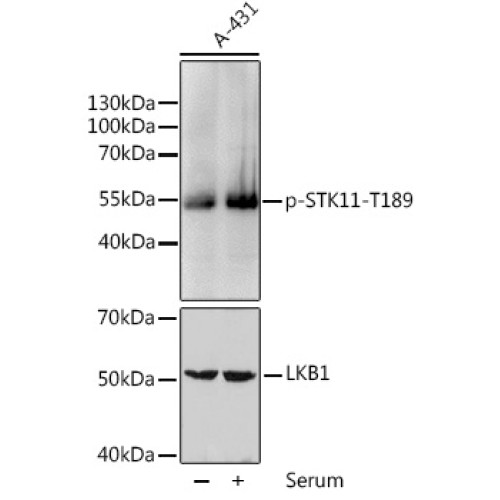 Phospho-STK11-T189 Rabbit pAb