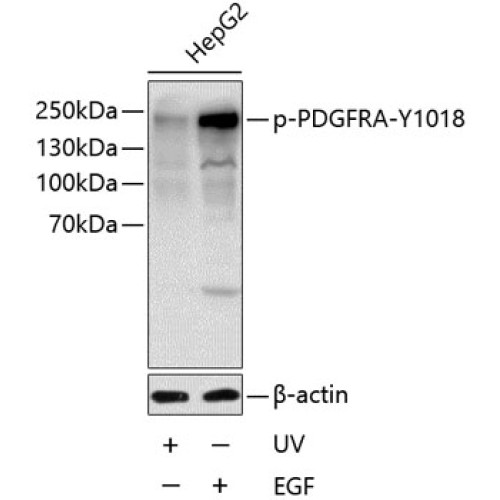 Phospho-PDGFR alpha-Y1018 Rabbit pAb