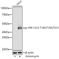 Phospho-JNK1/2/3-T183/T183/T221 Rabbit mAb