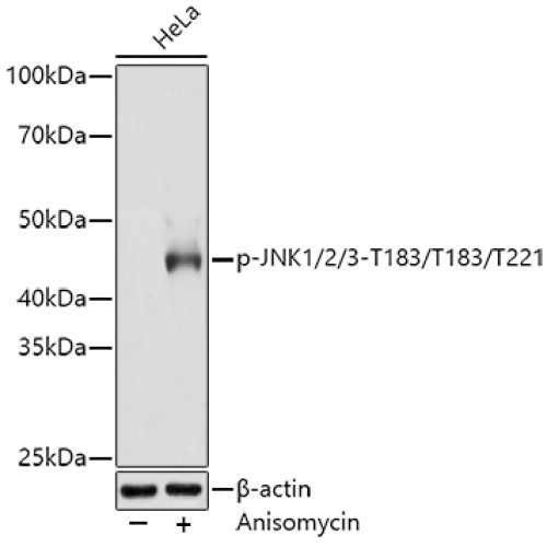 Phospho-JNK1/2/3-T183/T183/T221 Rabbit mAb