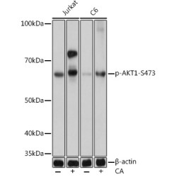Phospho-AKT-S473 Rabbit mAb