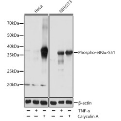 Phospho-eIF2α-S51 Rabbit mAb