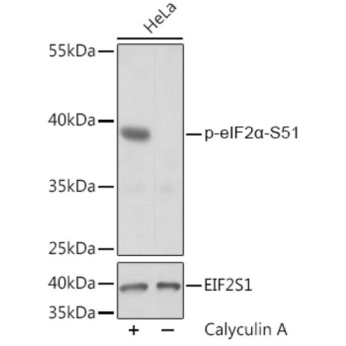 Phospho-eIF2α-S51 Rabbit pAb