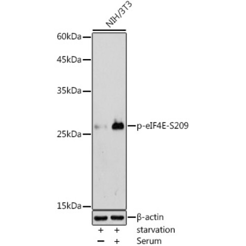 Phospho-eIF4E-S209 Rabbit pAb