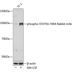 Phospho-STAT5A-Y694 Rabbit mAb