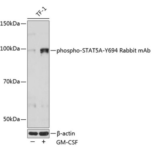 Phospho-STAT5A-Y694 Rabbit mAb