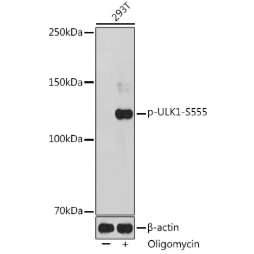 Phospho-ULK1-S555 Rabbit pAb