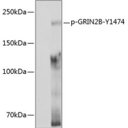 Phospho-GRIN2B-Y1474 Rabbit pAb