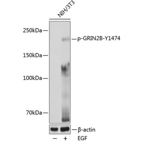 Phospho-GRIN2B-Y1474 Rabbit pAb
