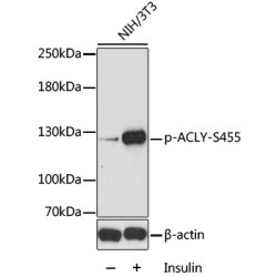 Phospho-ACLY-S455 Rabbit pAb