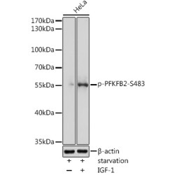 Phospho-PFKFB2-S483 Rabbit pAb