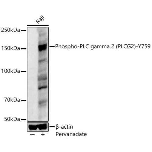 Phospho-PLC gamma 2 (PLCG2)-Y759 Rabbit pAb