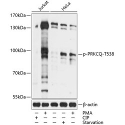 Phospho-PRKCQ-T538 Rabbit pAb