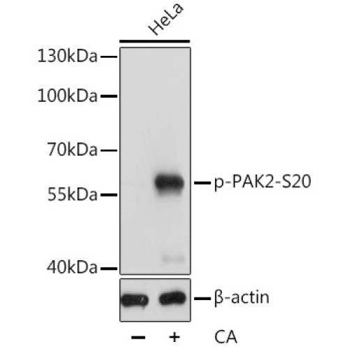 Phospho-PAK2-S20 Rabbit pAb