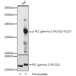 Phospho-PLC gamma 2 (PLCG2)-Y1217 Rabbit pAb