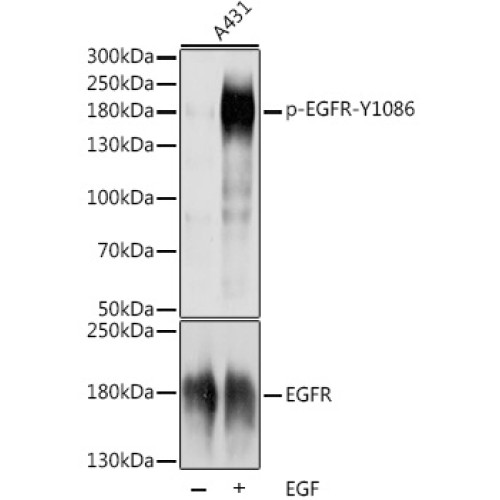 Phospho-EGFR-Y1086 Rabbit pAb
