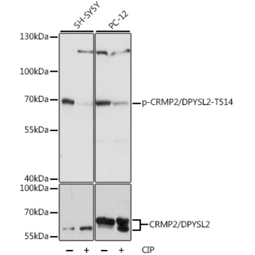 Phospho-CRMP2/DPYSL2-T514 Rabbit pAb